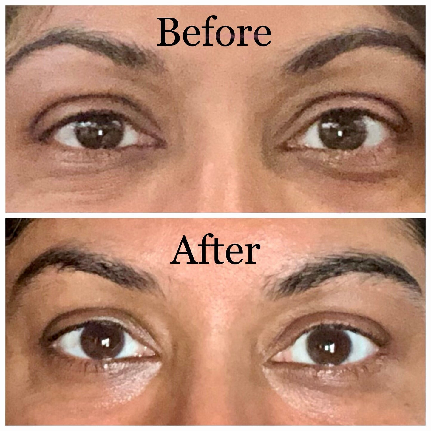 Undereyes Don't Lie Undereye and Décolleté Oil